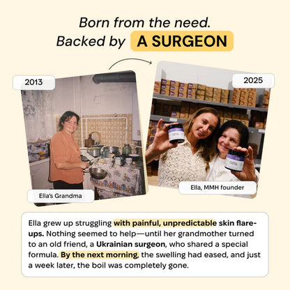 Universal Flare Care