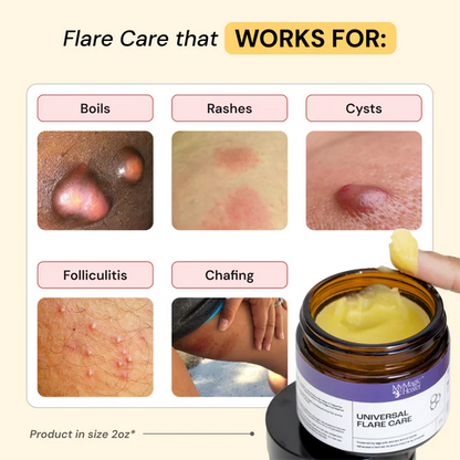 Universal Flare Care