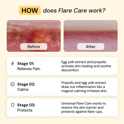 Universal Flare Care