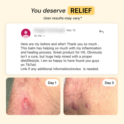 Universal Flare Care